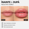REEDLE SHOT LIP PLUMPER™ – VOLUM VIZIBIL ÎN 60 SECUNDE